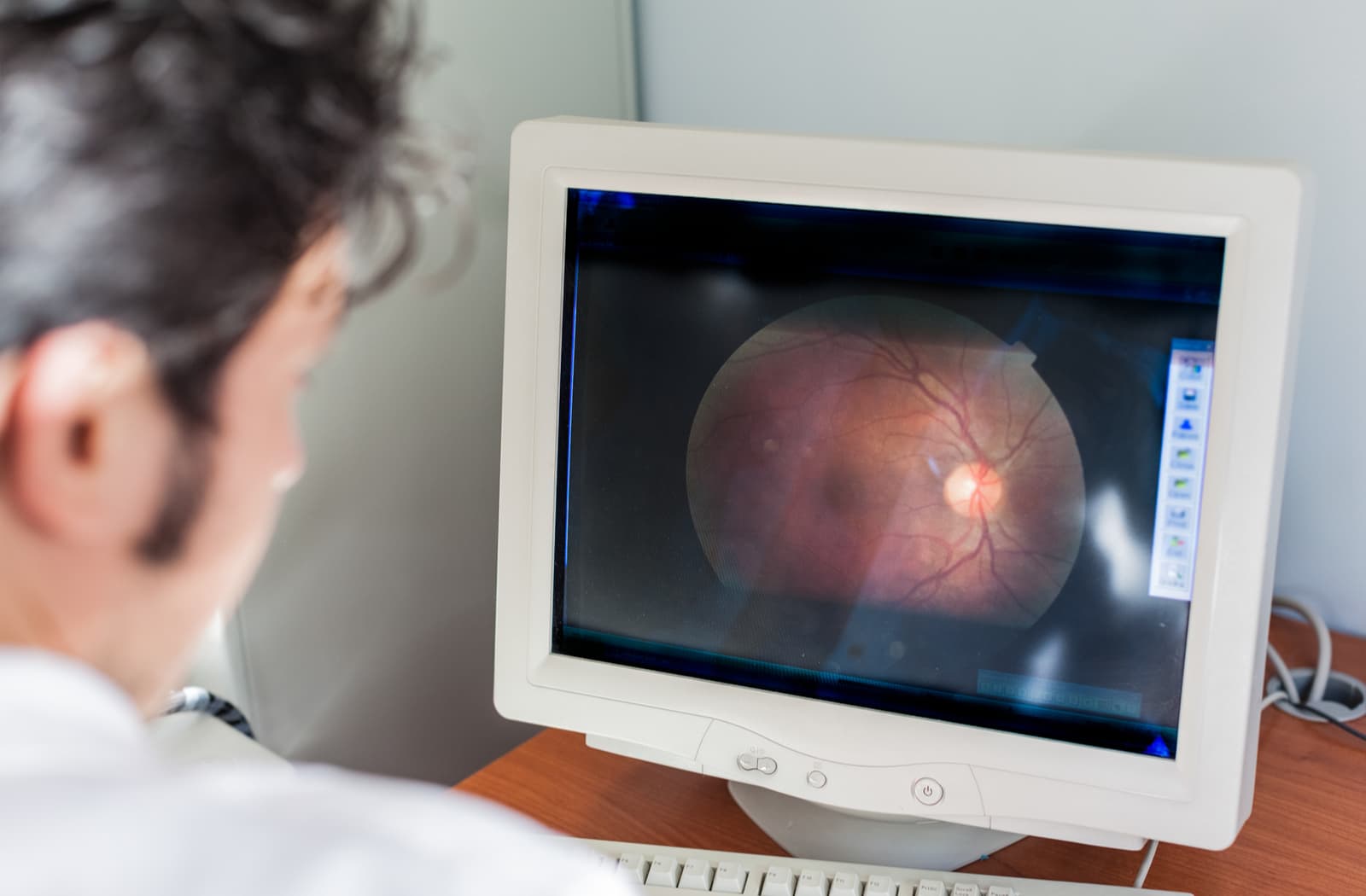 Optometrist looking at retinal imaging on a computer screen