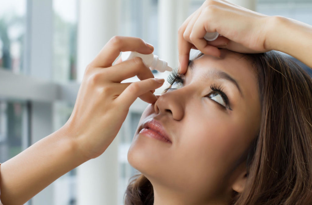 A girl is holding a small white bottle of an eye solution near her right eye and pouring a few drops on her eye.